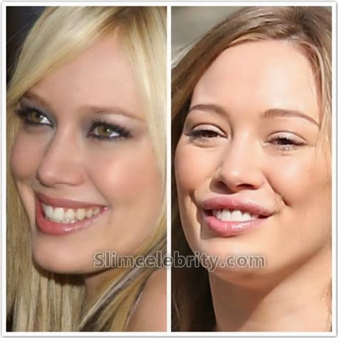 hillary duff nose job|Hilary Duff squeals as she gets nose swab taken during。